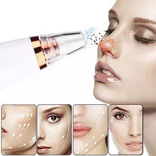 Cargar imagen en el visor de la galería, Succionador de Poros
